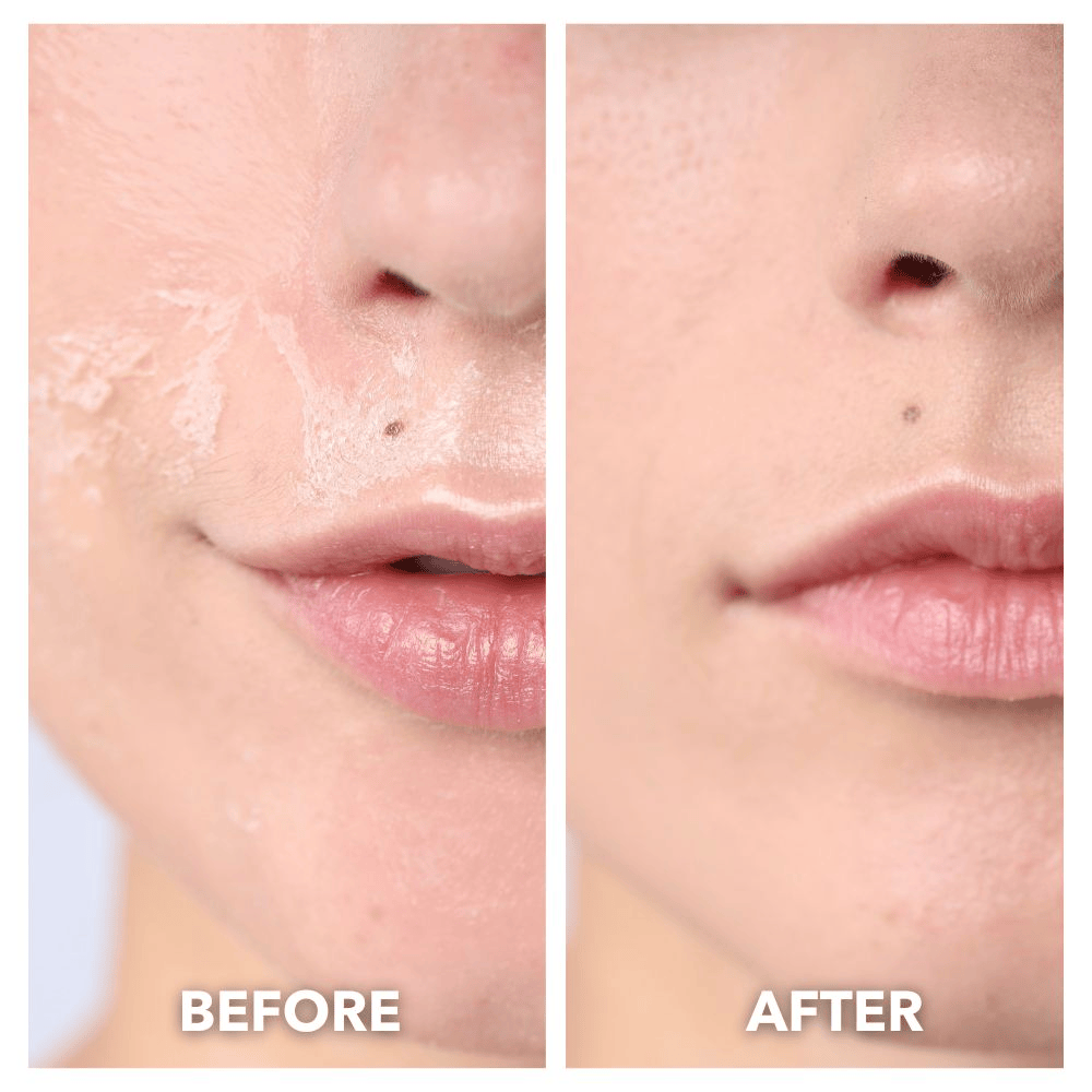 TONE & TOWEL LUXE™ Pro Max LED Therapy Mask