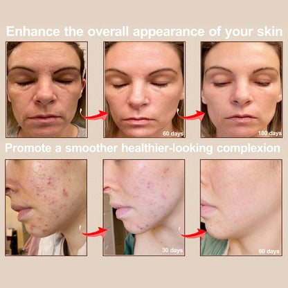 TONE & TOWEL LUXE™ Pro Max LED Therapy Mask